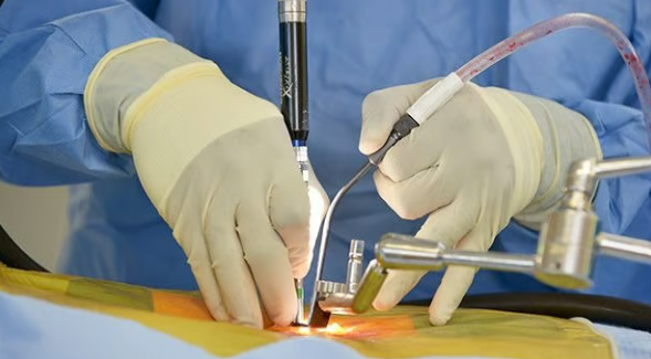 Spinal Surgery